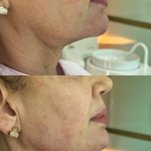 466768174_555865264068732_6395684362191309521_n