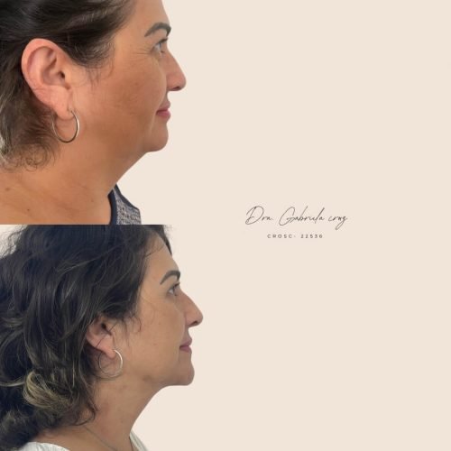 512311486_18130627075429272_1519367095329569153_n