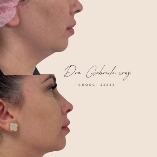 530840942_18134897950429272_4341922542311202287_n