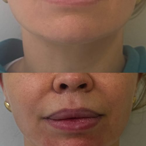 551726867_17961095684988618_8663564989793412435_n